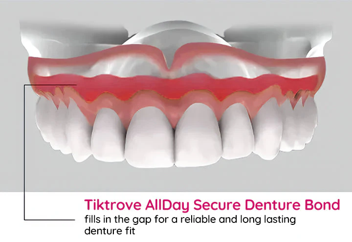 TIKTROVE AllDay Secure Denture Bond - Image 8