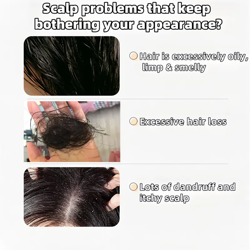 Anti-Hair Fall Hair Loss Treatment Shampoo Oil - Image 2