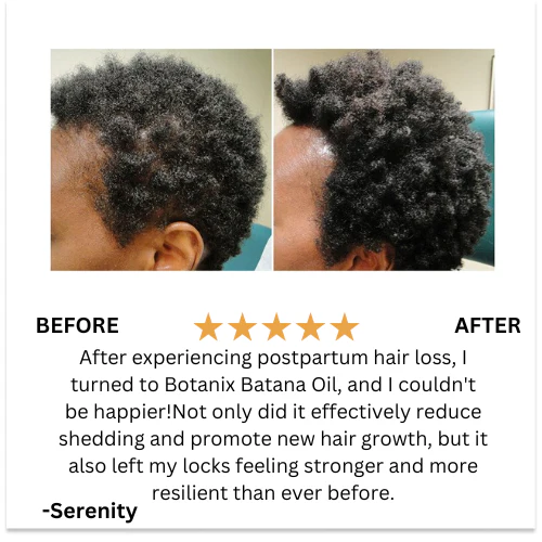Batana Natural Hair Growth Oil 2.0 - Image 5