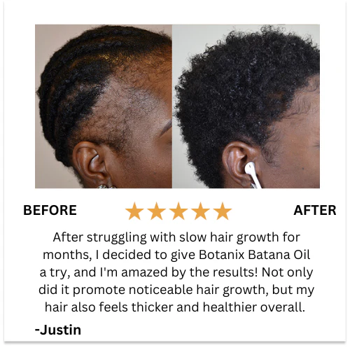 Batana Natural Hair Growth Oil 2.0 - Image 6