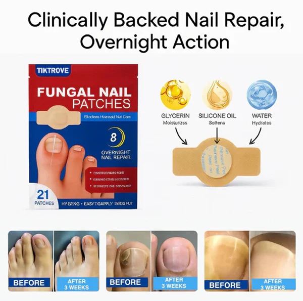 Tiktrove Fungal Nail Renewal Patches - Image 2