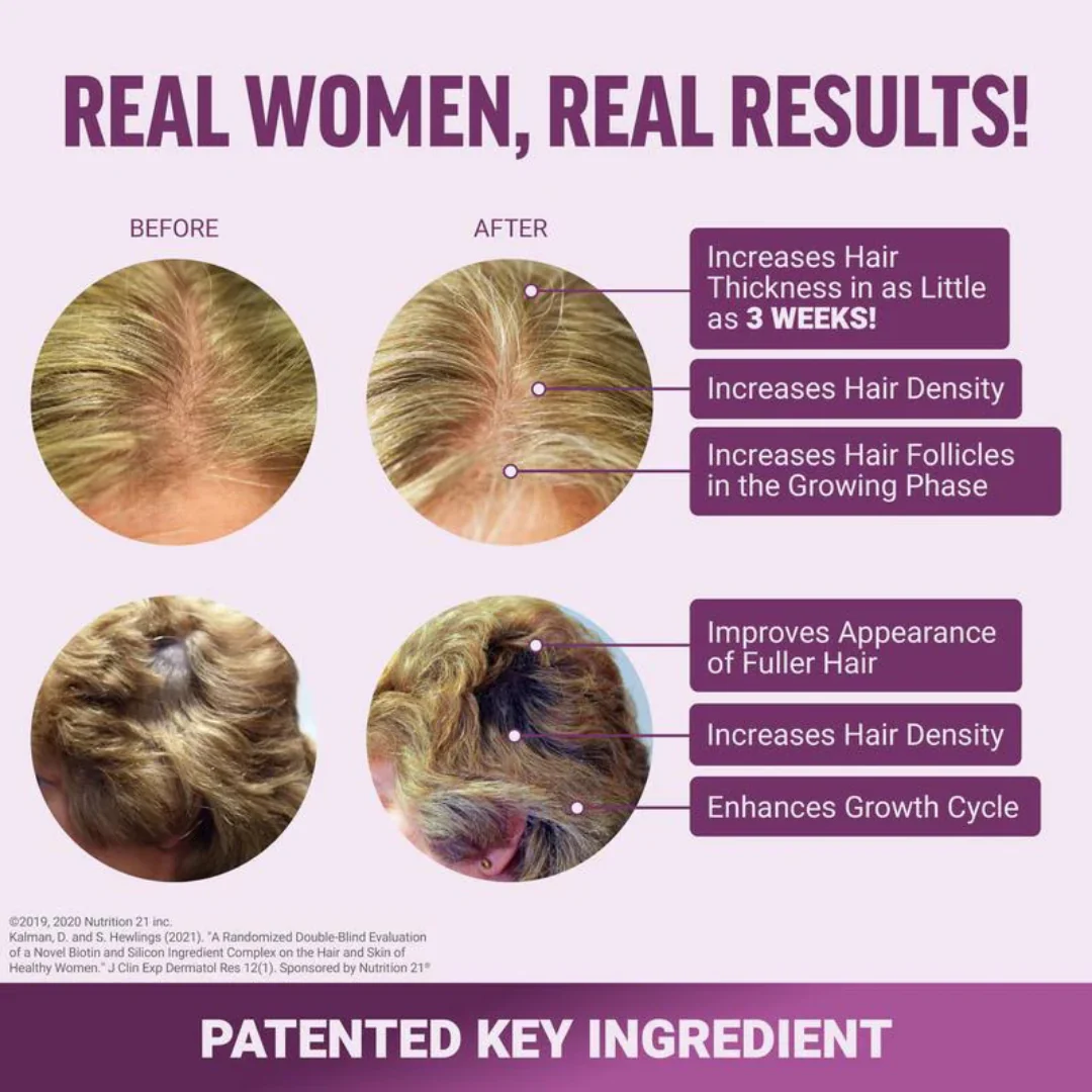 Hair Growth Accelerator Soft Chews - Image 3