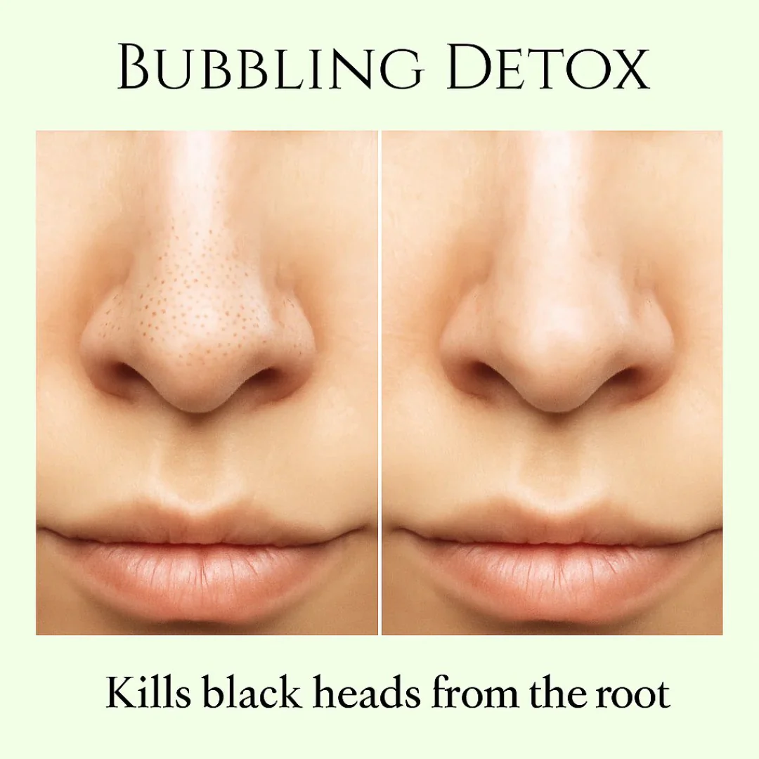 Holy Basil Bubble Deep Cleansing Mask - Image 12