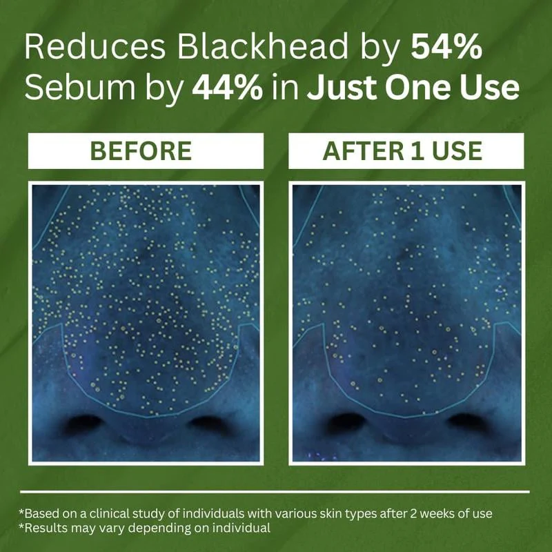 Holy Basil Bubble Deep Cleansing Mask - Image 4