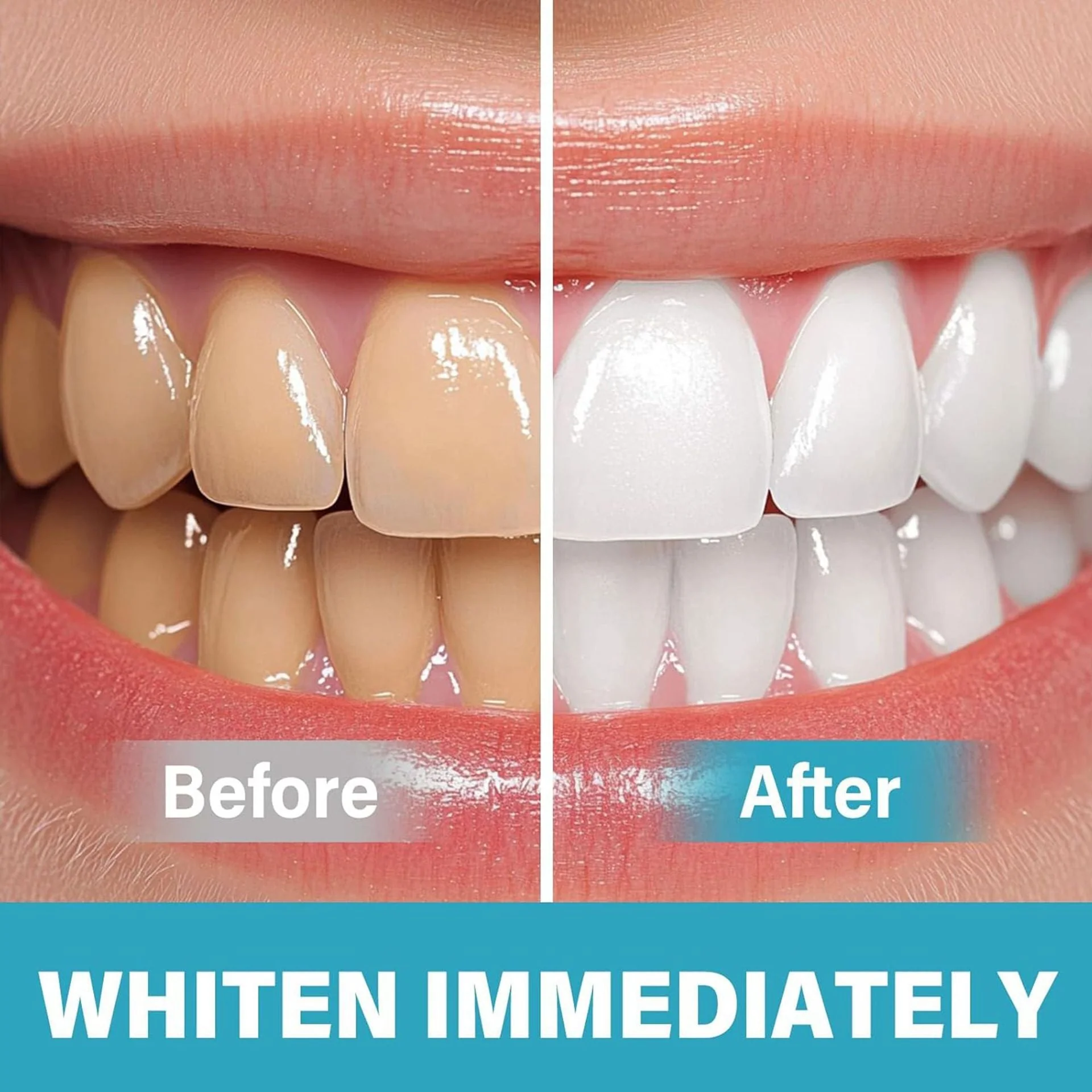 Instant Teeth Whitening Paint - Image 5