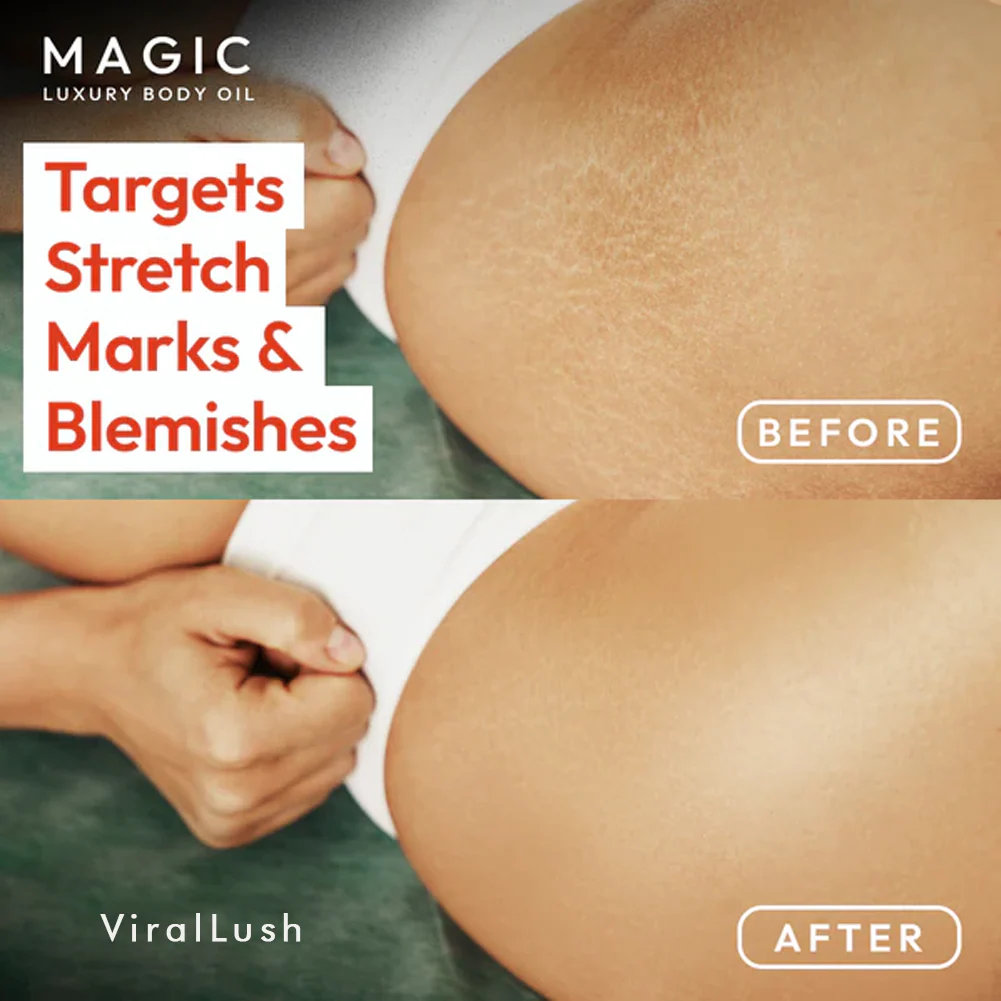 Magic Body Oil - 100ml - Image 3