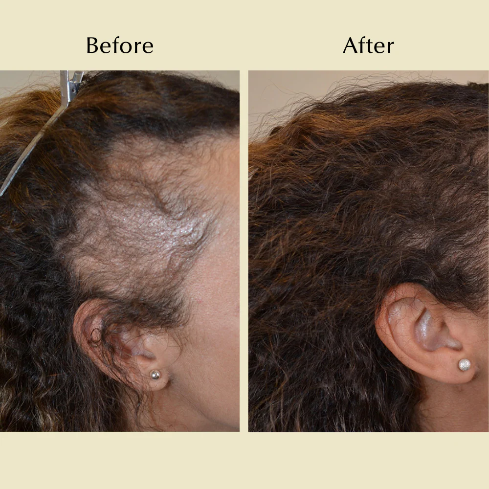 Natural Hair Growth Oil - Image 2