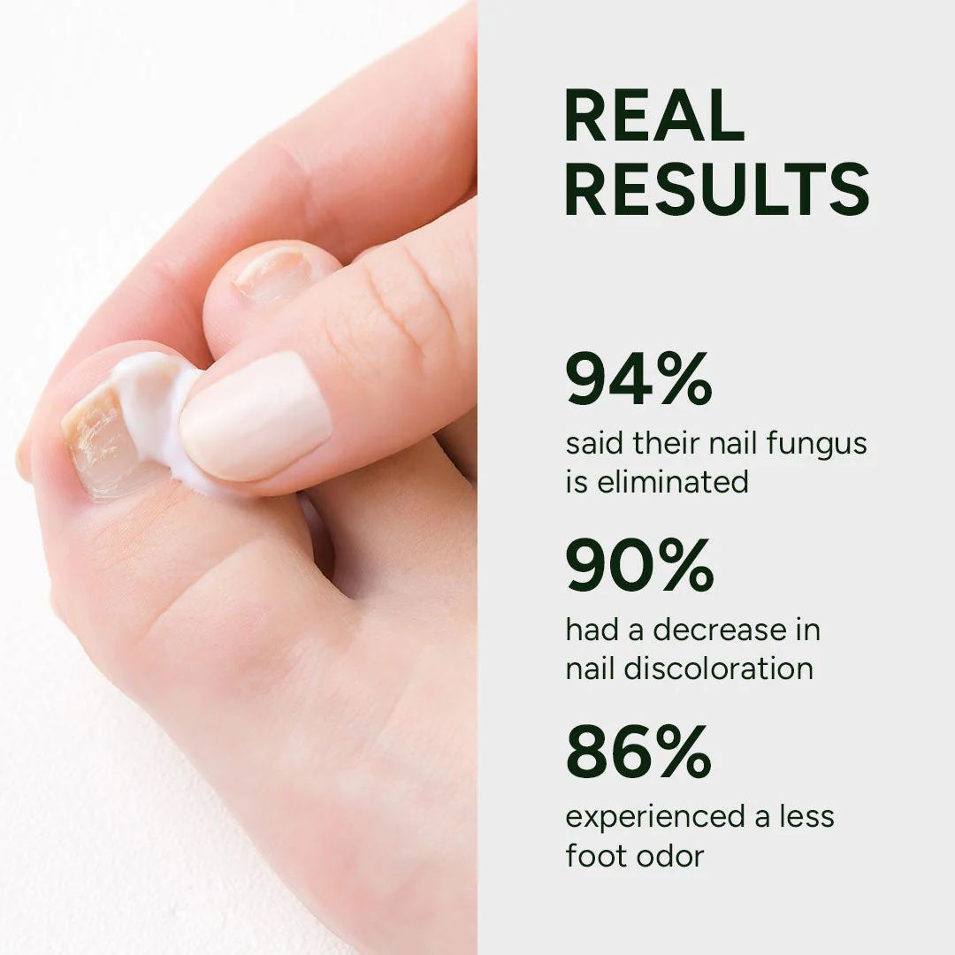 Nail Fungus Treatment Gel - Image 2