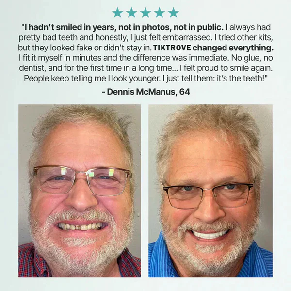 Tiktrove Quick Fit Dentures - Image 10