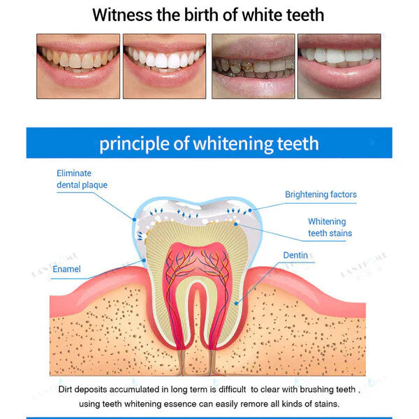 Teeth Whitening Essence - Image 11