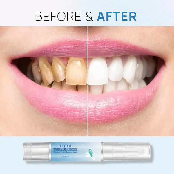 Teeth Whitening Essence - Image 8