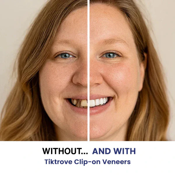 Tiktrove Clip-on Veneers - Image 4