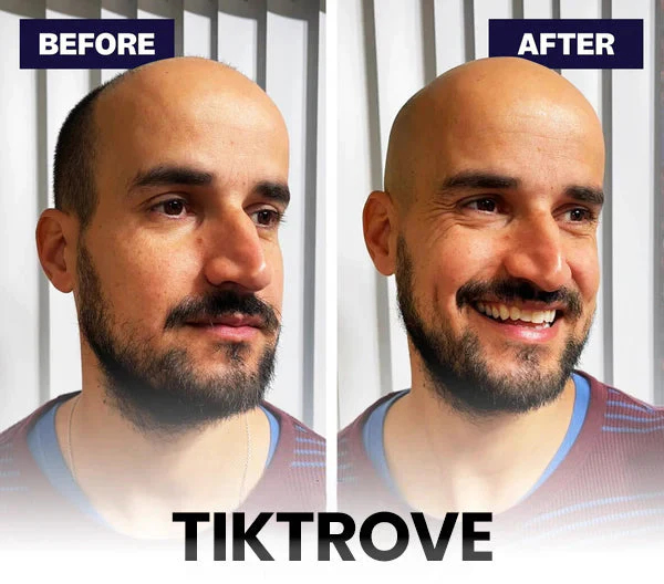 Tiktrove 9.0 ULTRA - Image 6