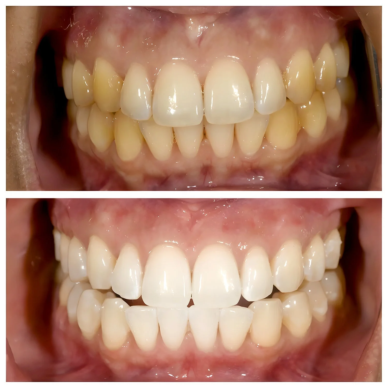 TriBright - ToothPaste - Image 7