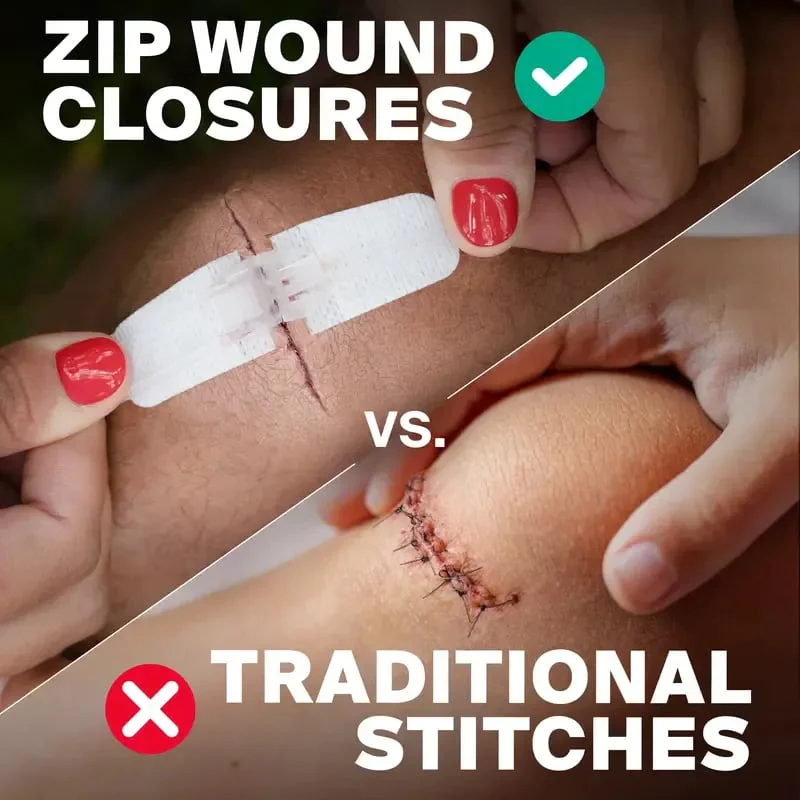 ⏰? Zip-Stitch Wound Closure Kit(1 Set 3 Pcs) - Image 2
