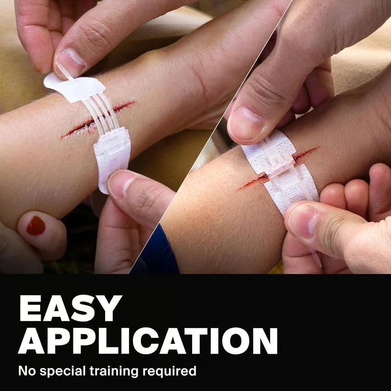 ⏰? Zip-Stitch Wound Closure Kit(1 Set 3 Pcs) - Image 4