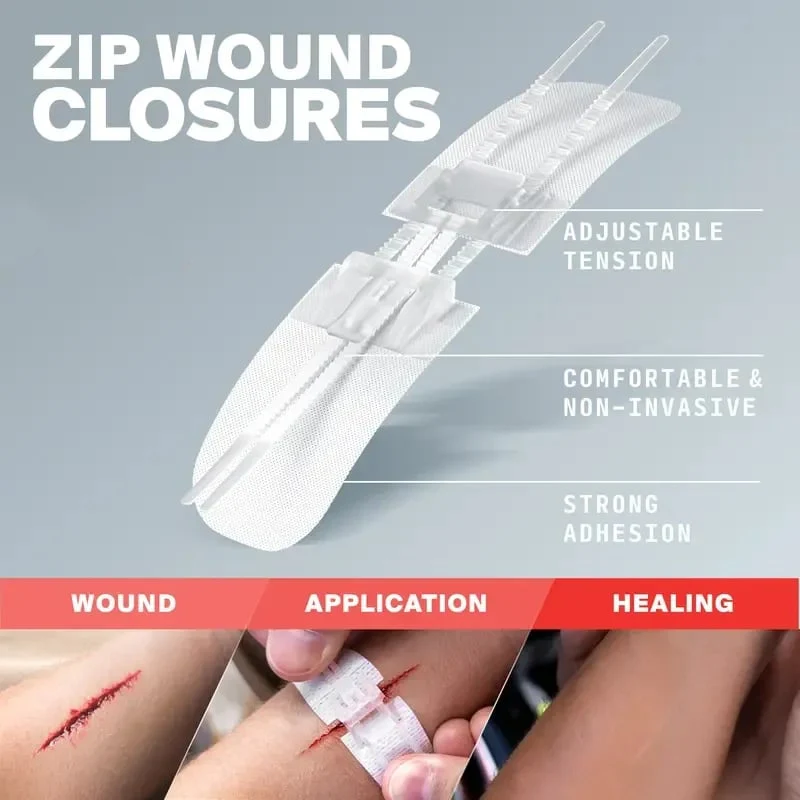 ⏰? Zip-Stitch Wound Closure Kit(1 Set 3 Pcs) - Image 6